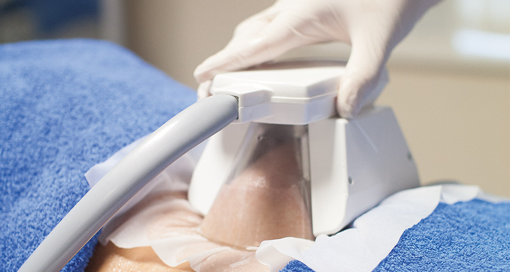 How Fat Freezing and HIFU Work Together? 2 Multiple Areas in One Session HIFU and Fat Freezing Maplehurst