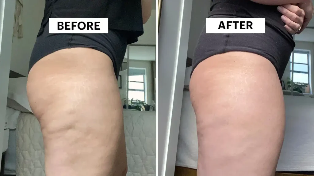 Do Toning Exercise Maplehurst Really Tackle Cellulite?